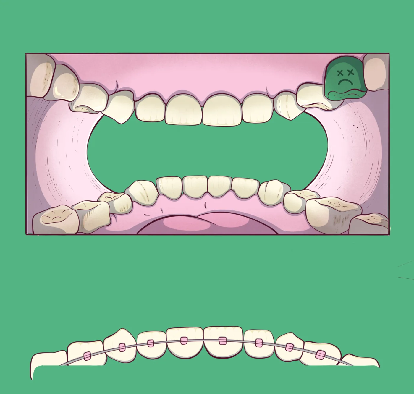 Arte final del sobre sobre verde: una boca abierta rosa ilustrada con dientes color crema y una muela verde triste en el panel interior, y dientes con brackets en la solapa de cierre